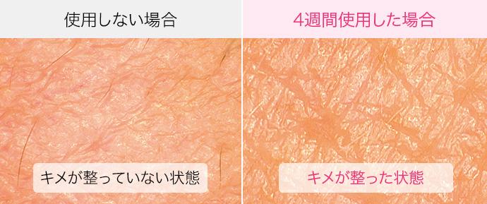 キメの整った美しい肌へ
