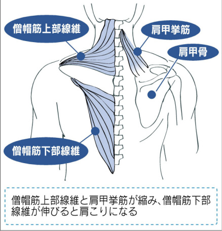 肩こりに関係する主な筋肉 僧帽筋(ソウボウキン)と肩甲挙筋(ケンコウキョウキン)
