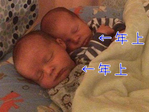 生まれた双子が両方とも兄貴になった珍出産