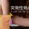 Thumbnail of related posts 072